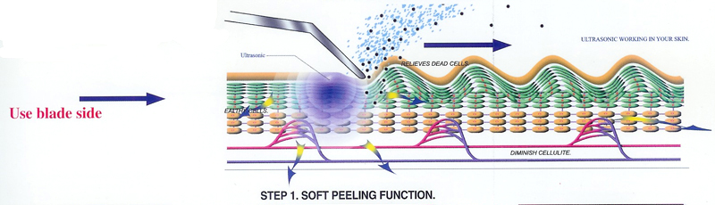 Rejuvena - Step One Diagram